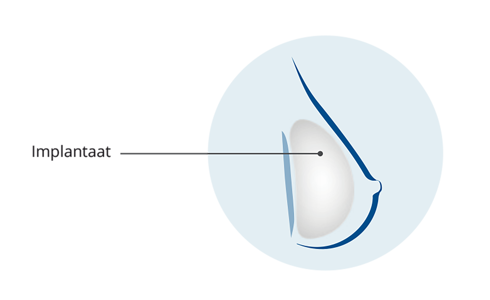 Implantaat