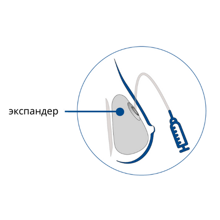 Expander