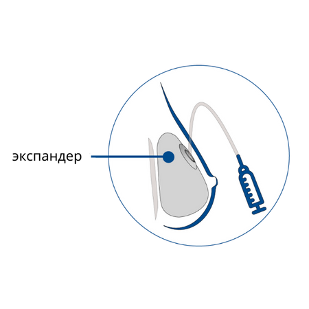 Expander